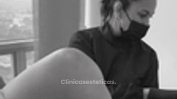 Labioplastia - Dra. Yulieth Figueroa Peñaranda