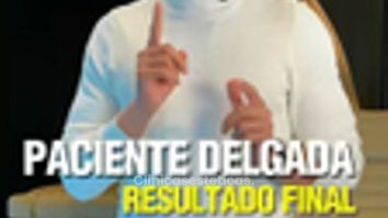 Lipoescultura - Dr. Francisco Zambrano