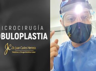 Lobuloplastia - Dr. Juan Carlos Herrera P.
