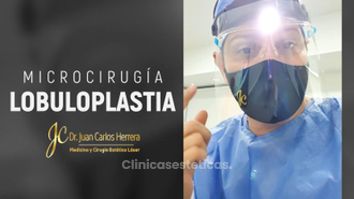 Lobuloplastia - Dr. Juan Carlos Herrera P.