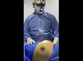 Mamoplastia de aumento - Dr. Luis Fernando Reyes & Dra. Nicole Echeverry
