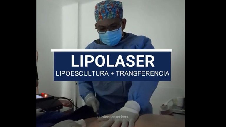 Lipolaser - Dr. Victor Hugo Quevedo