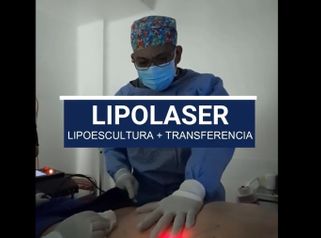 Lipolaser - Dr. Victor Hugo Quevedo