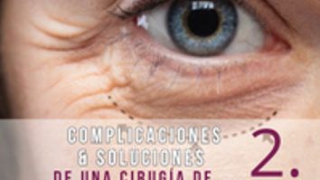 Complicaciones & Soluciones en Cirugía de Parpados