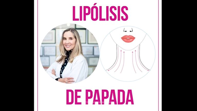 Lipolísis láser de papada - Doctora Alexandra Mora