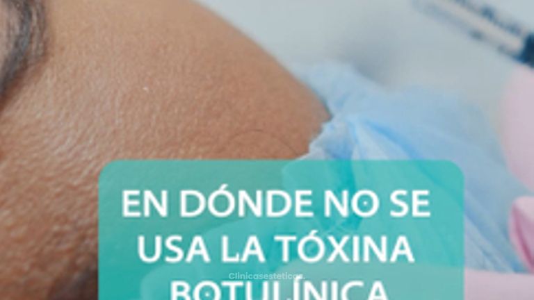 CONTRAINDICACION DEL BOTOX FHD - Novastética