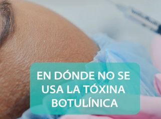 CONTRAINDICACION DEL BOTOX FHD - Novastética