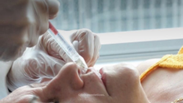 Aumnto y perfilados de Labios - Dra. Yulieth Figueroa Peñaranda