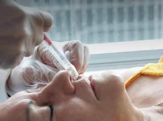 Aumnto y perfilados de Labios - Dra. Yulieth Figueroa Peñaranda