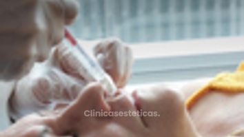 Aumnto y perfilados de Labios - Dra. Yulieth Figueroa Peñaranda