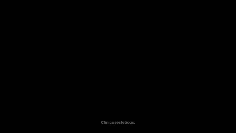 Ginecomastia - Dr. Reinel Mesa
