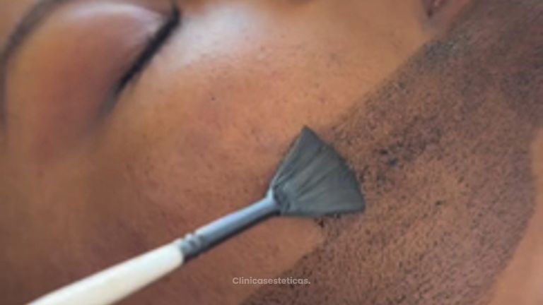 Hollywood peel - Dra. Yulieth Figueroa Peñaranda