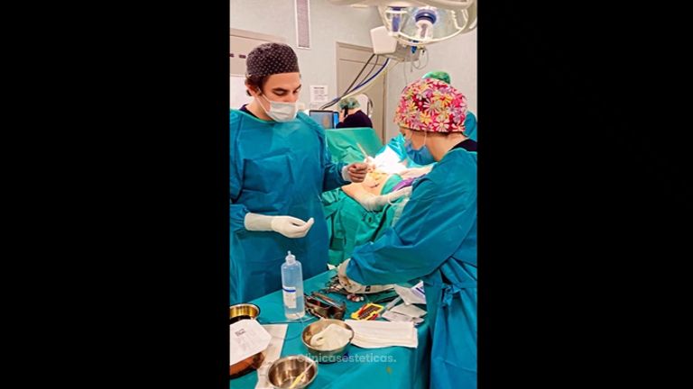 Mamoplastia de aumento - Dr. Felipe Galiano