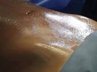 Lipoescultura HD - Clinica Vivir