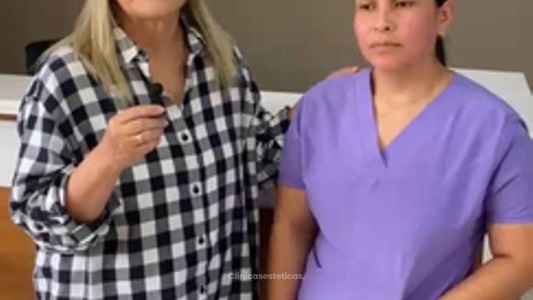 Testimonio paciente Cicatrices Acne - Prhomex Exthetic - Dr. Oscar Calle Londoño.