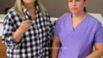 Testimonio paciente Cicatrices Acne - Prhomex Exthetic - Dr. Oscar Calle Londoño.
