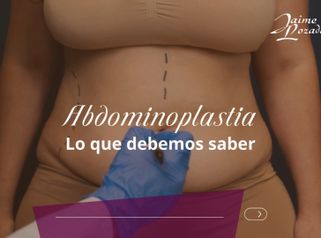 Abdominoplastia lo que debemos saber - Dr. Jaime Lozada Ruiz
