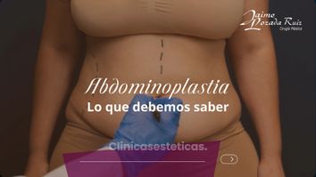Abdominoplastia lo que debemos saber - Dr. Jaime Lozada Ruiz