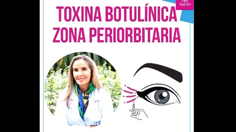 Toxina Botulinica - Doctora Alexandra Mora