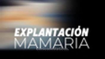 Explantacion mamaria - Dr. Jorge Puello White