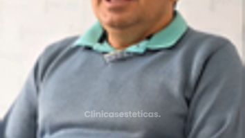 Testimonio Real de Restauración Capilar - Pilocare