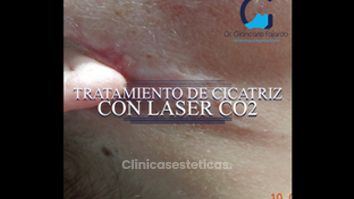 Cicatrices - Dr. Giancarlo Fajardo