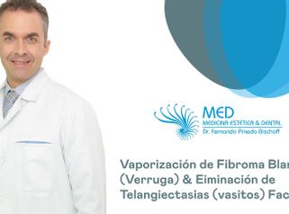 Verrugas - Dr. Fernando Pinedo Bischoff
