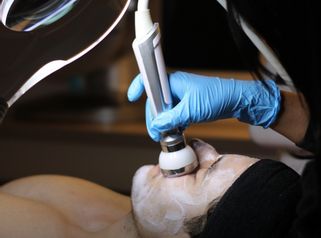 Limpieza facial Hidrafacial - Dra. Yulieth Figueroa Peñaranda