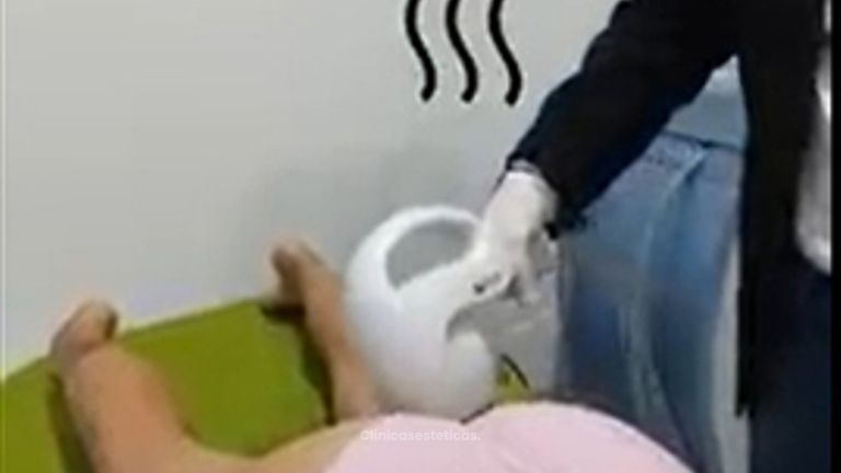 Procedimiento de Radiofrecuencia.