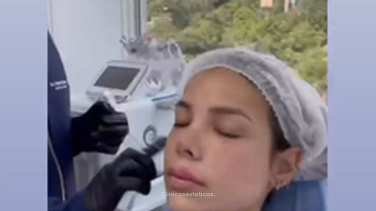Rejuvenecimiento Facial - Dr. Fabian Correa