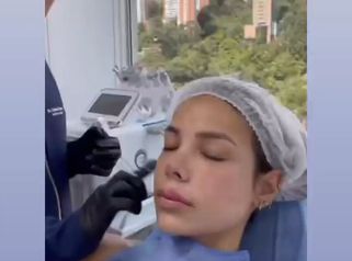 Rejuvenecimiento Facial - Dr. Fabian Correa