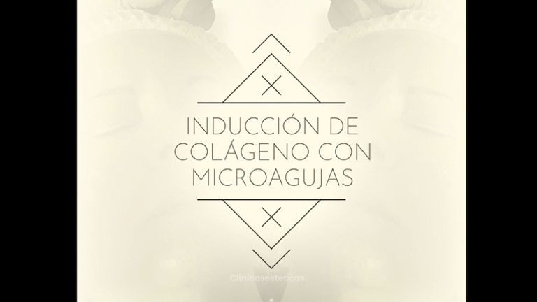 Inducción de colágeno con microagujas