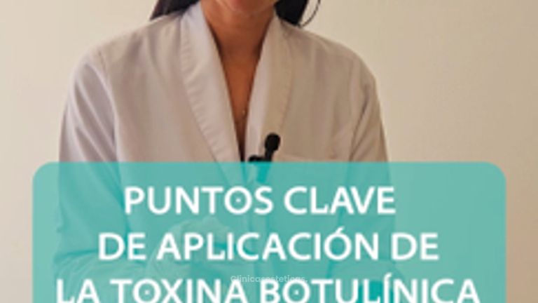 PUNTOS DE APLICACION DEL BOTOX FHD - Novastética