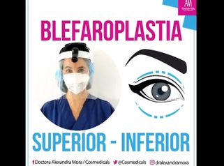 Blefaroplastia - Doctora Alexandra Mora