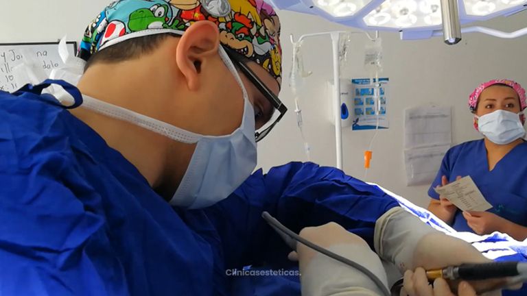 Mamoplastia de aumento - Dr. Johnatan L De Guevara