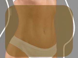 Liposucción - Dra. Nicole Echeverry