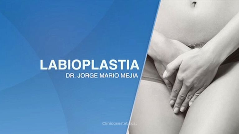 Labioplastia