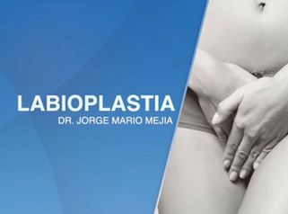 Labioplastia