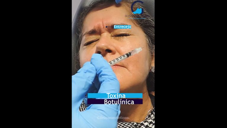 Toxina Botulínica - Dr. Giancarlo Fajardo