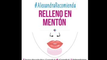 Relleno en mentón