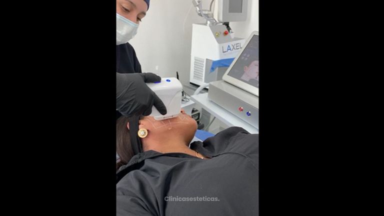 Rejuvenecimiento facial