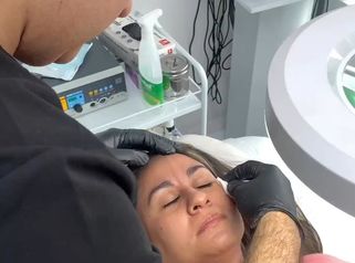 Toxina botulínica - Dr. Carlos Arturo Cervantes López