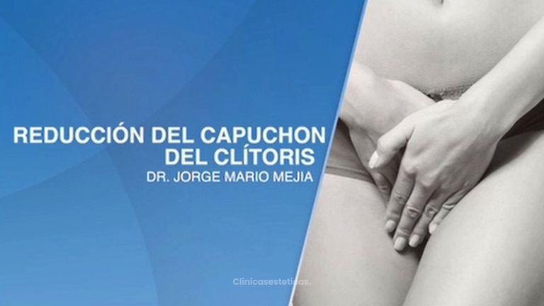 Reducción del capuchon del clítoris