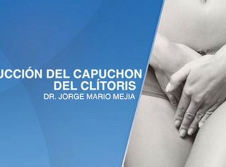 Reducción del capuchon del clítoris