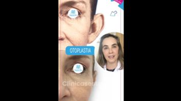 Otoplastia - Doctora Alexandra Mora