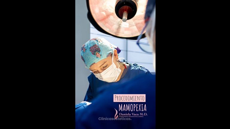 Mamopexia - Dra. Daniela Stephania Vaca Grisales