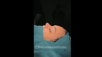 Rinoplastia - Dr Fulvio Alexander Correa