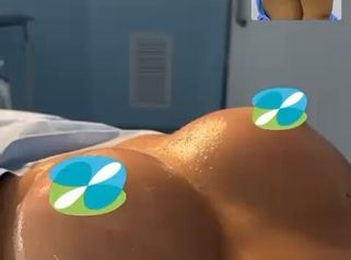 Mamoplastia de aumento - Clinica Vivir
