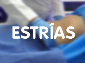 Estrías