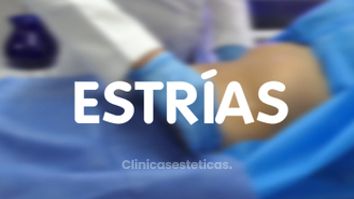 Estrías